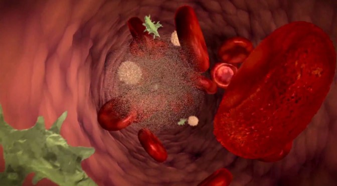 CARA TERBAIK CEGAH KANKER DARAH SEJAK DINI